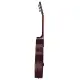 Baton Rouge X11C/P SCR